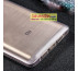 Ốp lưng Xiaomi Mi 5s Plus silicone trong suốt