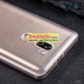 Ốp lưng Xiaomi Mi 5s Plus silicone trong suốt